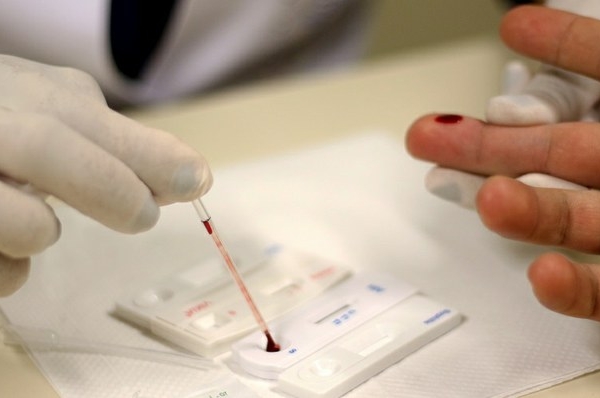 Anvisa aprova novo remédio para hepatite C